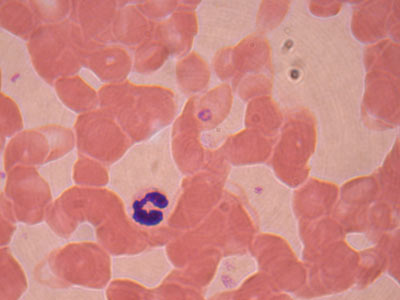 Plasmodium Falciparum Image