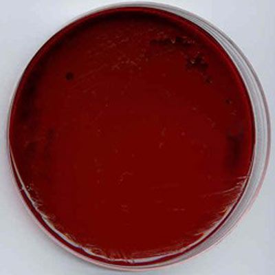 Eosin Methylene Blue Agar Image
