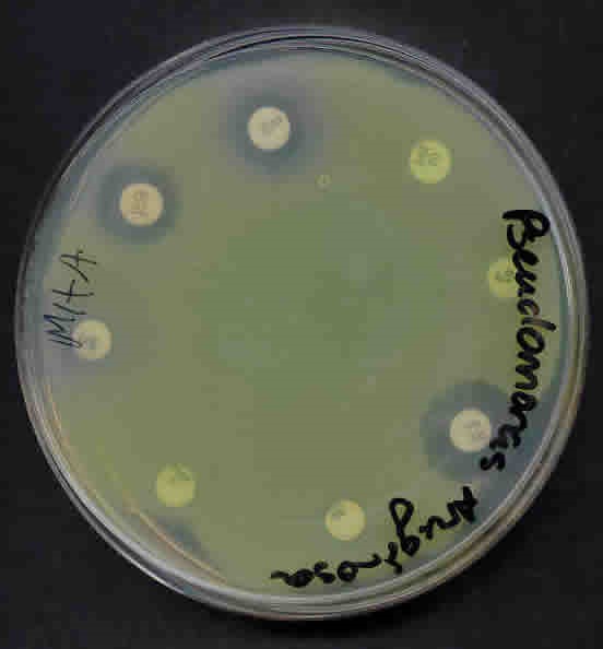 Pseudomonas Aeruginosa Image