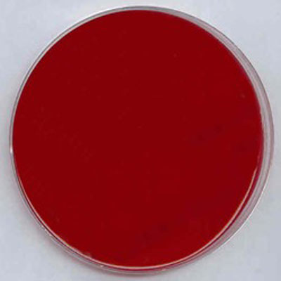 Hemolysis Blood Agar