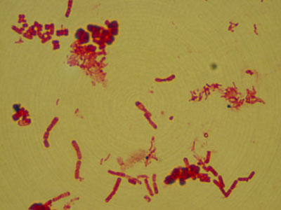Archaebacteria Image