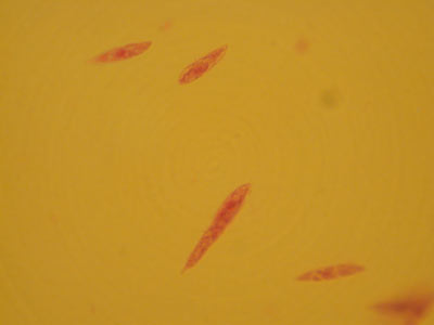 Euglena Image