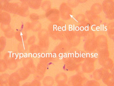 Trypanosoma Gambiense Image