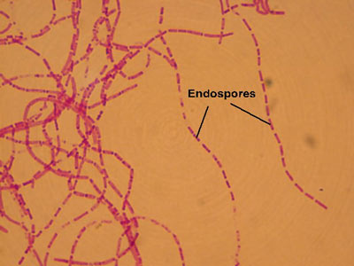 Bacillus Anthracis Image