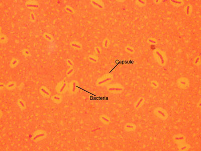 Bacterial Capsules Image
