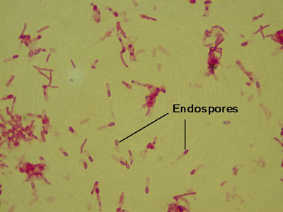 Clostridium Tetani Image