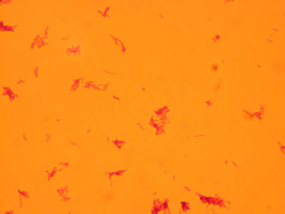 Mycobacterium Image
