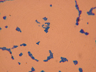 Staphylococcus Aureus Image