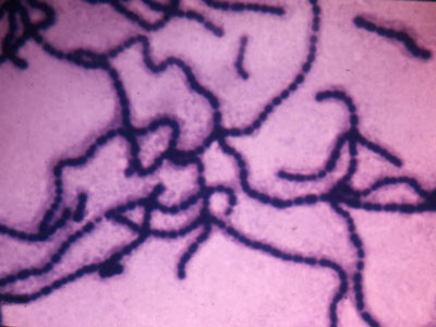 Streptococcus Faecalis Image