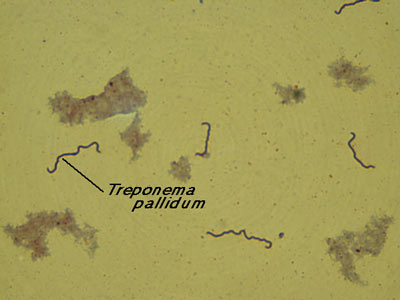 Treponema Pallidum Image