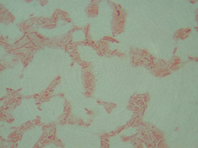 endospore staining lab report discussion